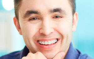 All About Smiles Ceramic Braces