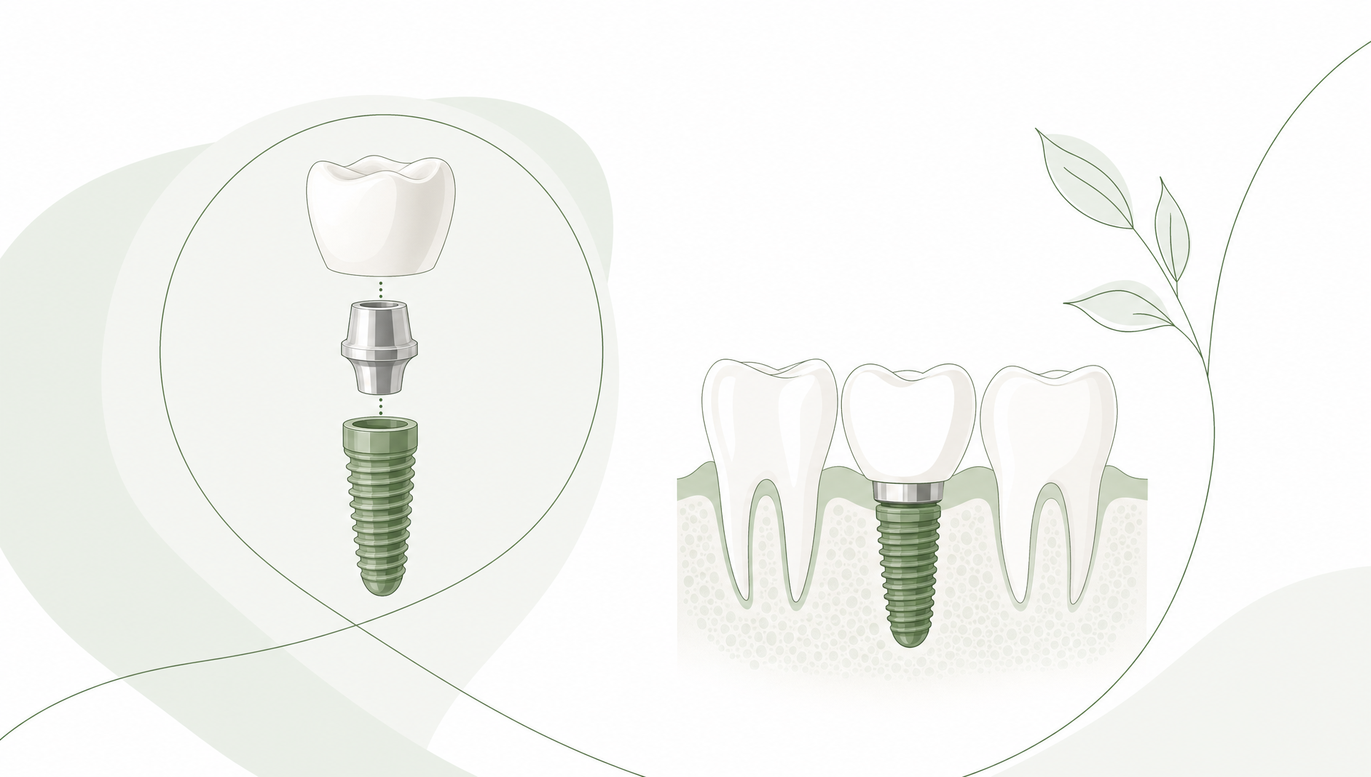 A close-up of a dental mirror, shade guide and a tooth model arranged on a clean tray, representing aesthetic smile planning.
