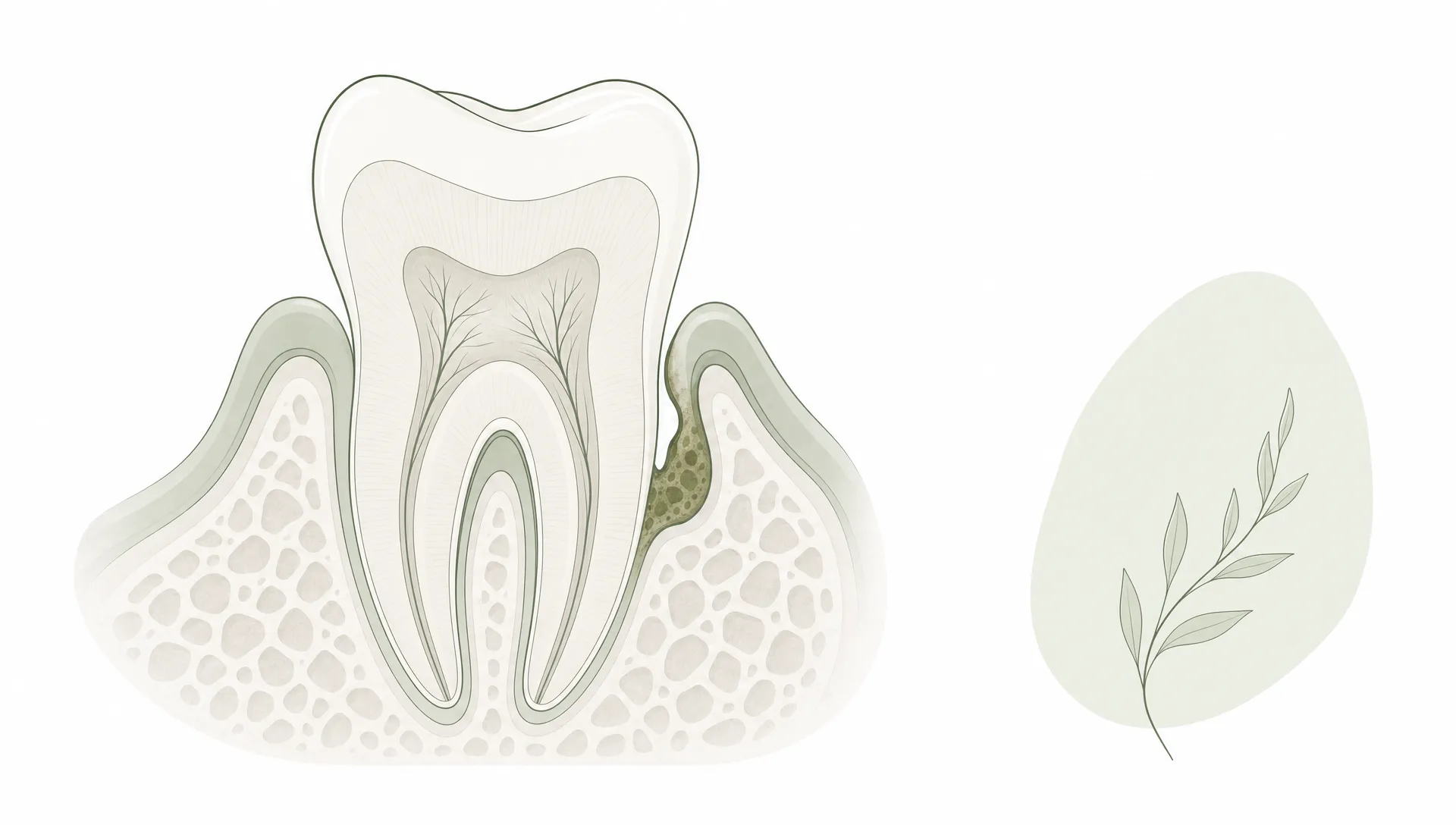 A simplified tooth and gum cross-section suggests gum health assessment.