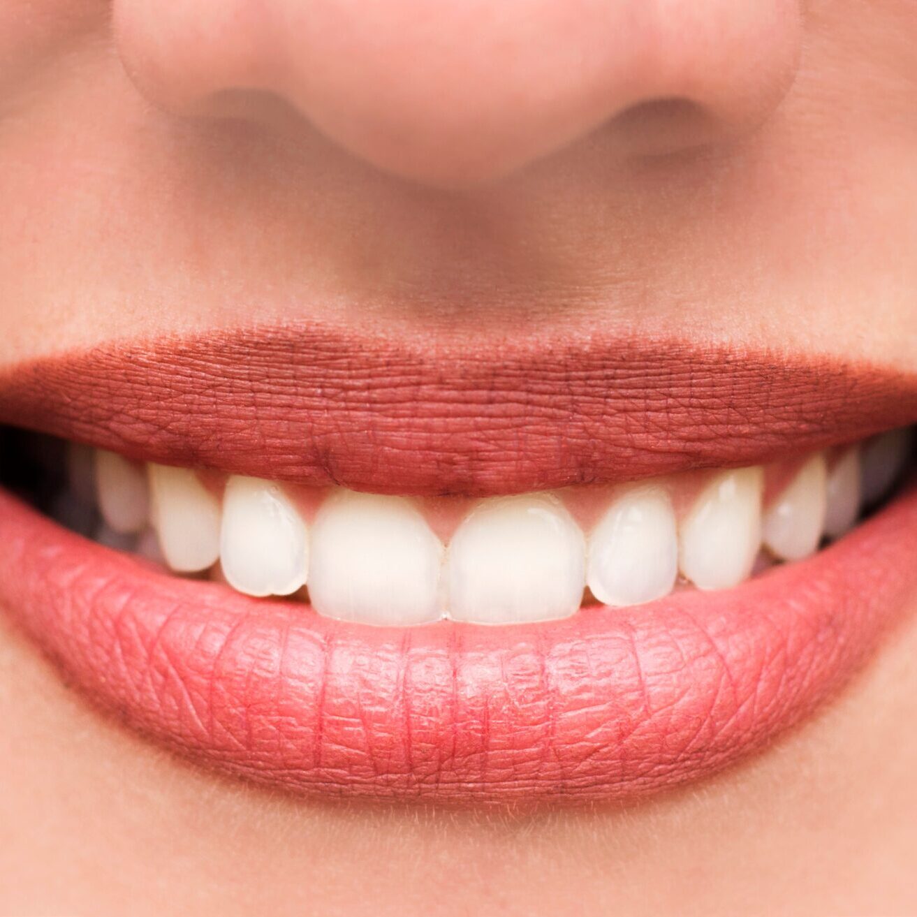 same day crowns Ettalong Same day crowns Kincumber