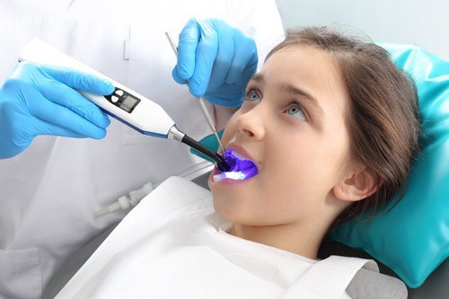 child fissure sealants ettalong kincumber dentist