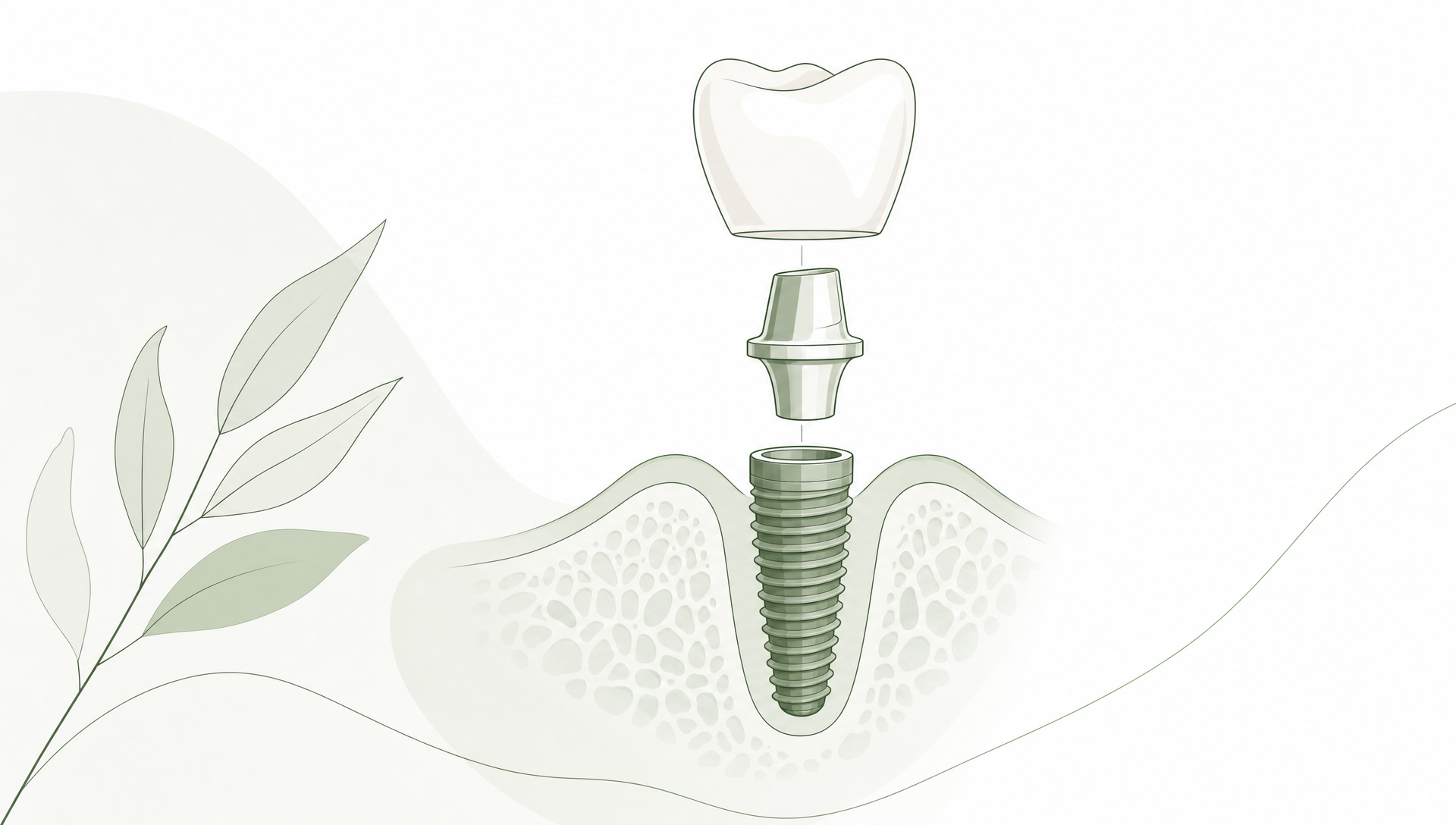 Premium editorial vector illustration for cosmetic dental treatment options, showing a refined facial profile beside veneer shells, a ceramic crown and a simplified dental arch with subtle planning lines; predominantly white background with restrained sage green accents, pale sage and soft sage panels, deep sage fine linework, generous negative space, calm contemporary dental care style, no text or logos.