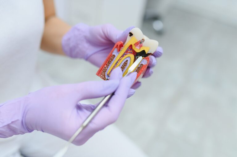 root canal therapy ettalong root canal therapy kincumber